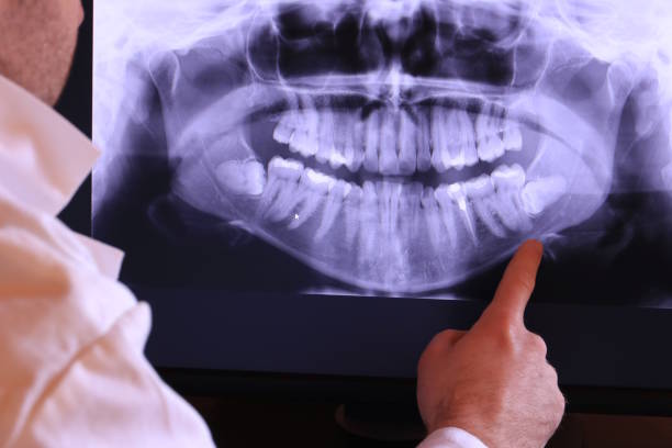 Best Emergency Dental Filling Replacement  in Dover, TN